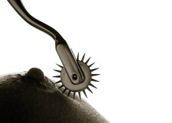 Wartenberg wheel