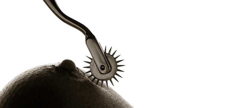 Wartenberg wheel